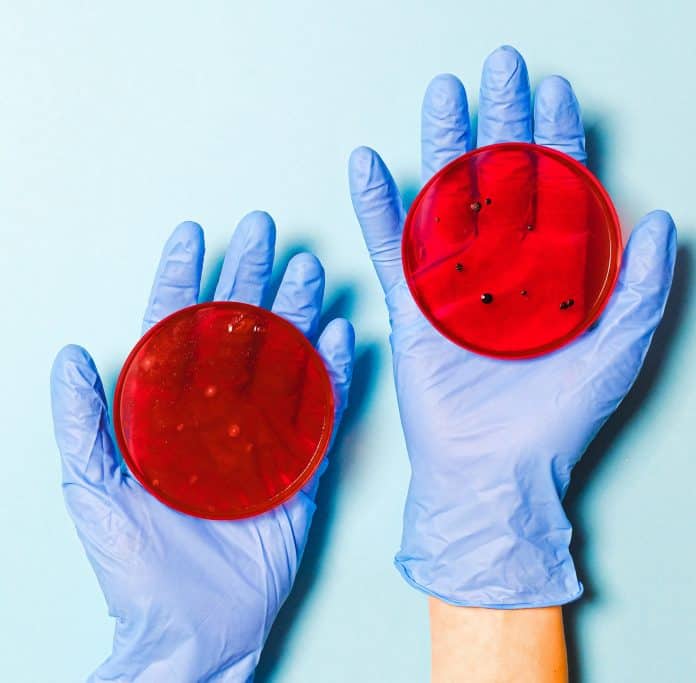 Fotografia de duas mãos com luvas azuis segurando dois recipientes vermelhos com o vírus da covid-19